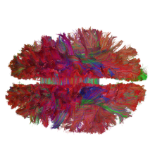 Tzourio-Mazoyer ; Hemispheric specialization ; Language & spatial attention ; Motor representations ; Statistical neuroanatomy ; Intrinsic connectivity ; White matter connectivity