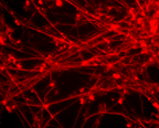 Red Neurons